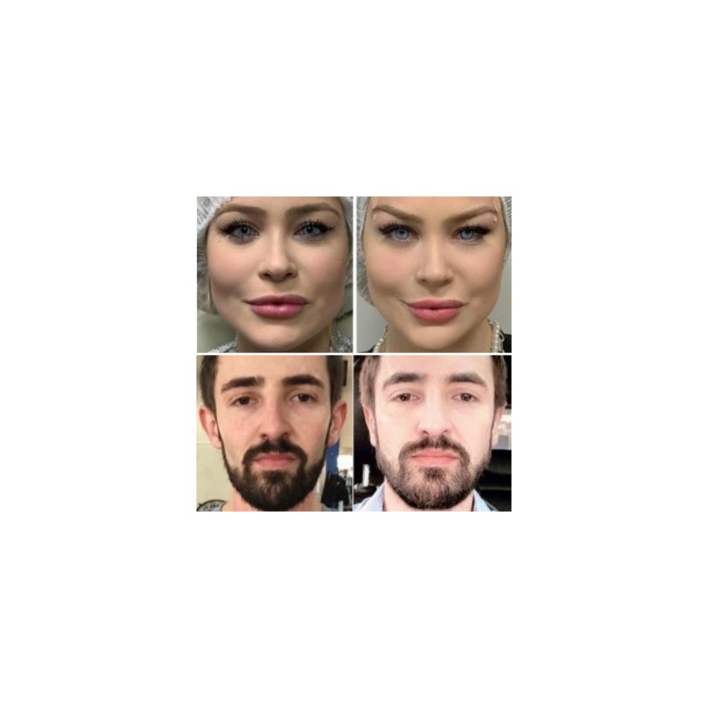 Queridinho dos influencers